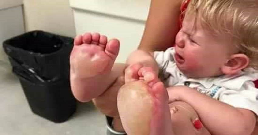 Une Nounou brûle sous les pieds d'un bébé avec une poêle chaude !