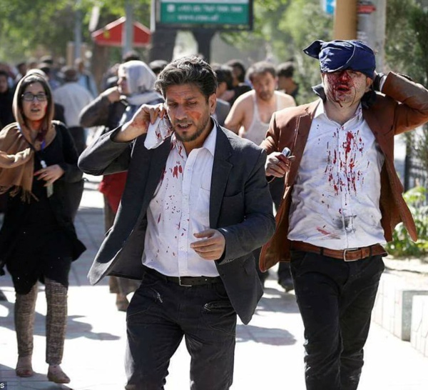 Attentat à Kaboul ,Afghanistan : au moins 80 morts et 350 blessés